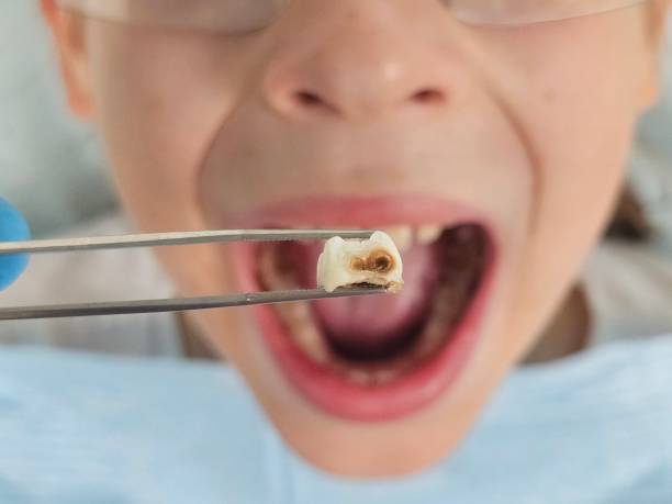 Best Emergency Treatment for Jaw Pain or Injury in Beckett, NJ